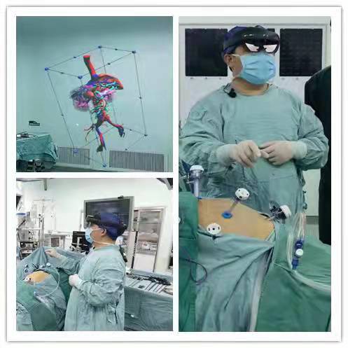 宫外孕腹腔镜手术步骤(图1)